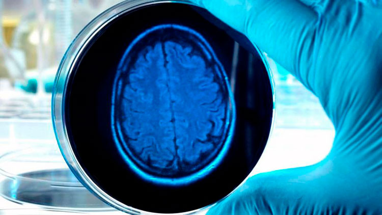 Крошечный мозг не способен мыслить: ему не хватает тела, которое помогло бы ему обрабатывать информацию Крошечный мозг не способен мыслить: ему не хватает тела, которое помогло бы ему обрабатывать информацию