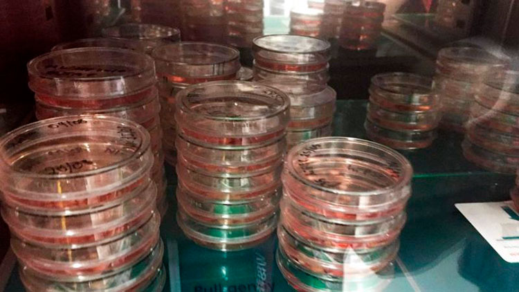 Как и зачем ученые выращивают человеческий мозг