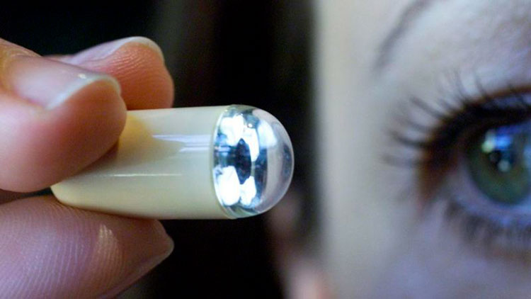 капсульная эндоскопия