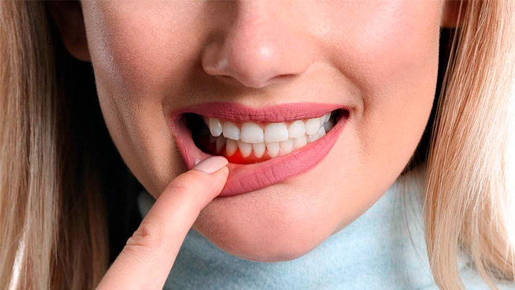 Воспаление десен увеличивает риск сердечно-сосудистых заболеваний