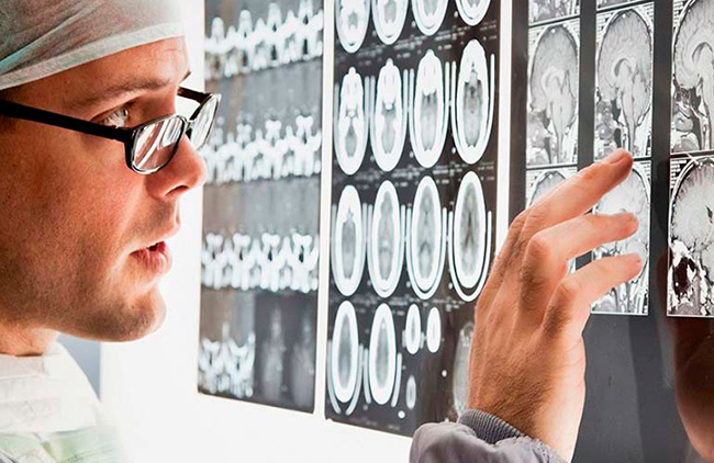 Ученые выяснили, что по снимкам МРТ можно прогнозировать развитие ПТСР