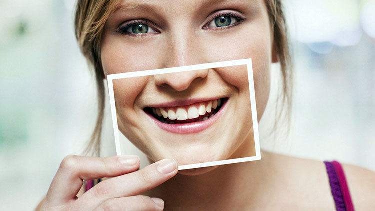 Имплантация зубов: 5 интересных фактов