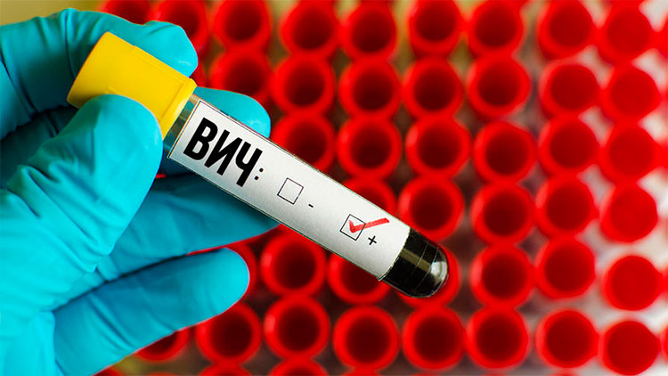 В Минске лечение от ВИЧ получает лишь 1 из 4 заразившихся