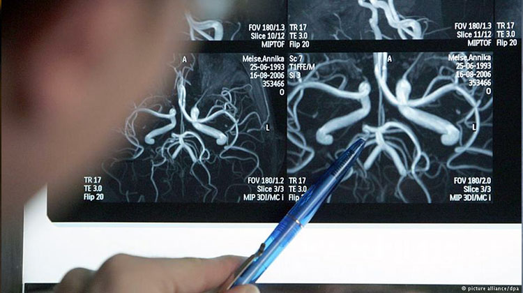 Генетический анализ поможет определить риск рака груди