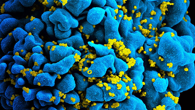 Найден способ уничтожить «спящие» клетки вич