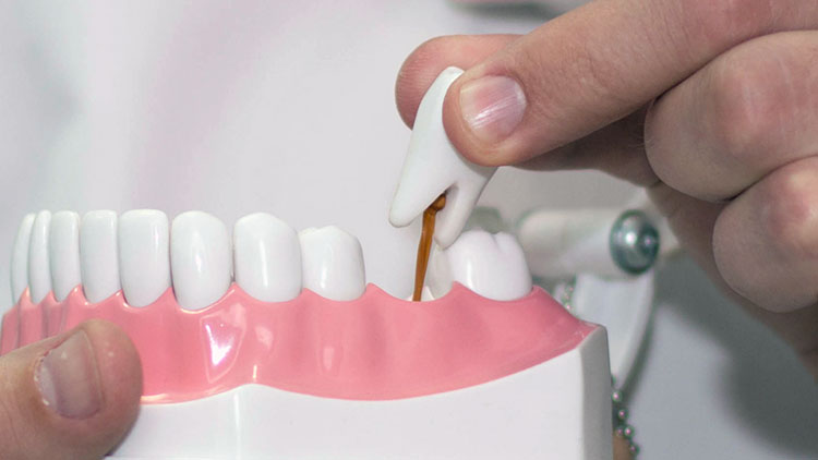 Выбираем вид зубного протезирования