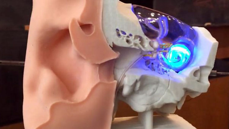 Созданы импланты, возвращающие слух