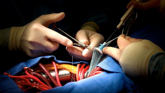 кластеры сердечных клеток выращиваются на специальной подложке кластеры сердечных клеток выращиваются на специальной подложке