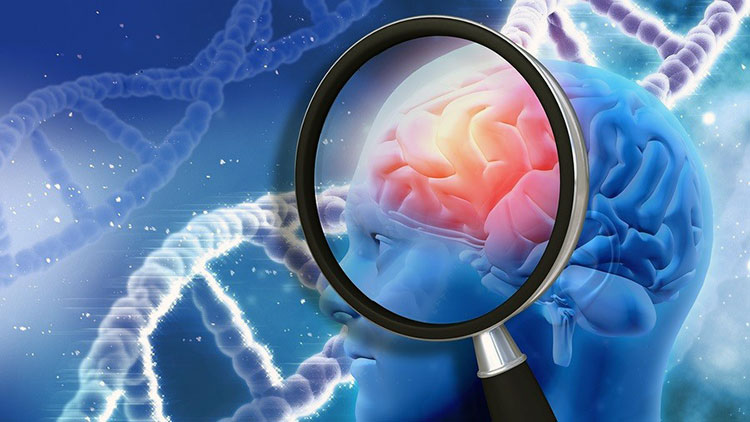Ученые восстановили память при болезни Альцгеймера