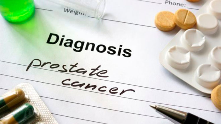 Врачи нашли способ лечить рак простаты с помощью бактерий