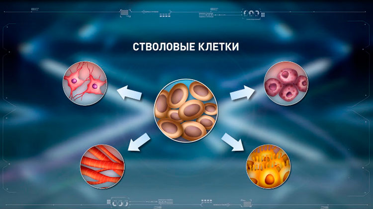 лечение стволовыми клетками