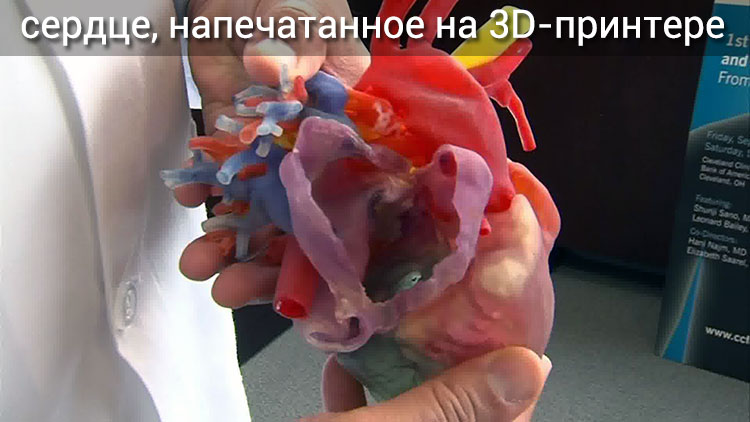 первое в мире сердце, напечатанное на 3D-принтере