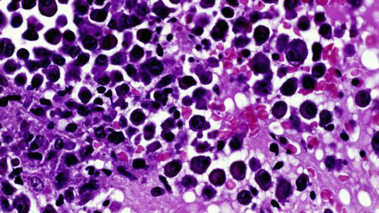 Рак может быть излечим, утверждают ученые