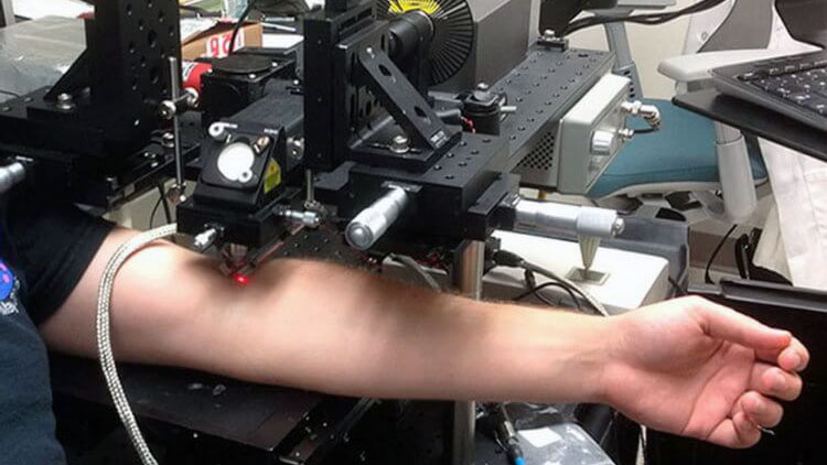 лазер, уничтожающий раковые клетки в крови