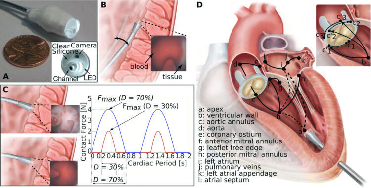Создан самоуправляемый робот-хирург для операций на сердце Создан самоуправляемый робот-хирург для операций на сердце