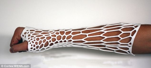 Гипс на 3d принтере