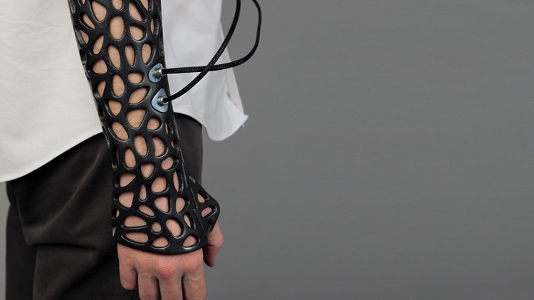 Созданный на 3D-принтере аналог гипса с ультразвуком ускорит лечение переломов