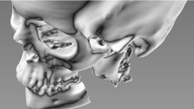 Созданные путем 3D-печати органы