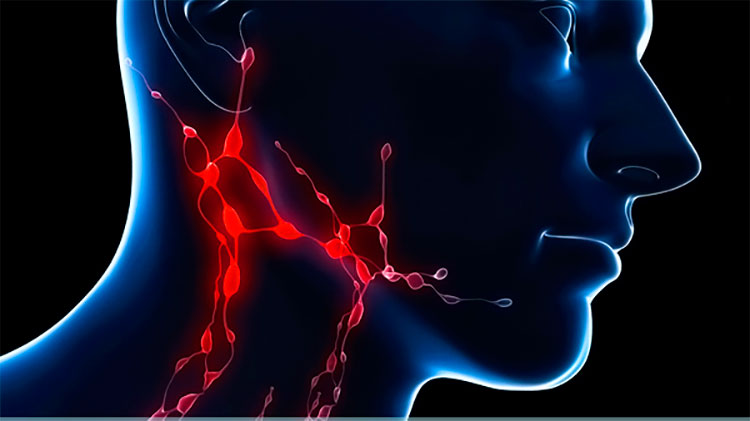 Рак лимфоузлов (лимфома) – методы лечения