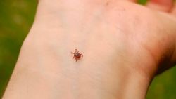 Вакцина против клещей предотвратила болезнь Лайма